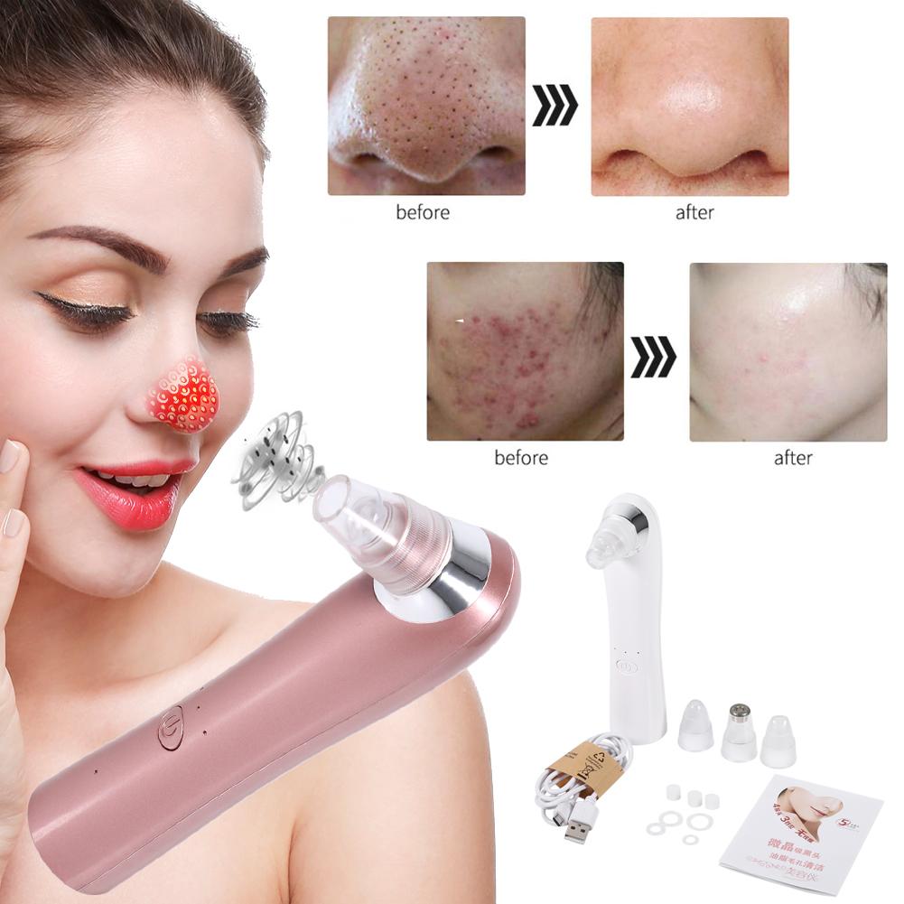 Vacuum Blackhead Removal Facial Blackhead Removal