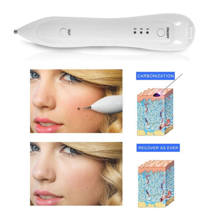 Freckle Laser Spot Laser Mole Removal Machine